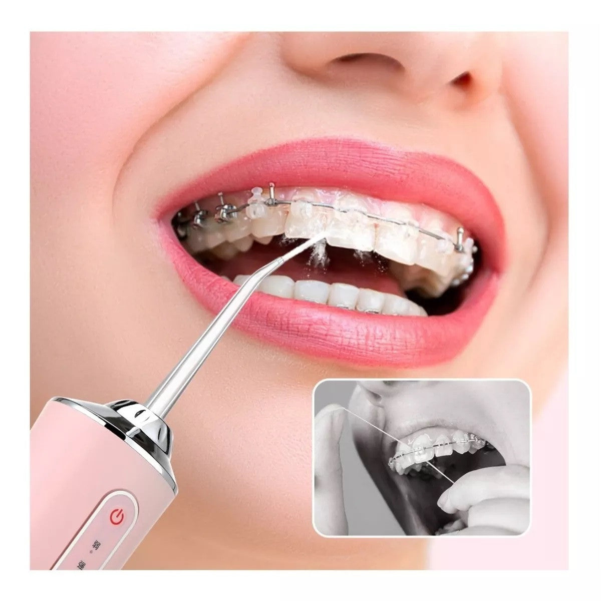 Irrigador Oral Recargable Sarro 4 Boquil